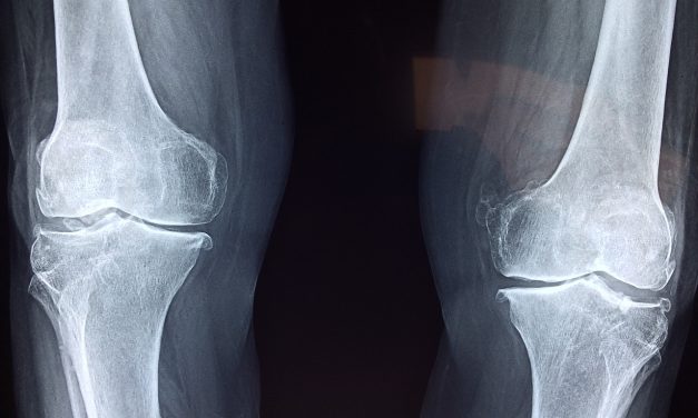 Définition d’orthophédie et le fonctionne en clinique du service orthopédie